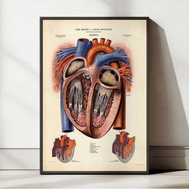 Hjertet 1951 - Anskuelsesbillede