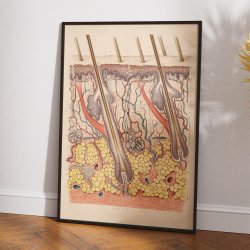 Huden 1916 - Anskuelsesbillede