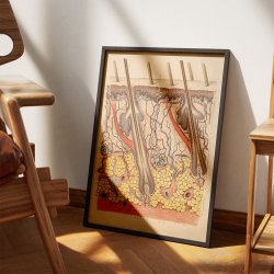 Huden 1916 - Anskuelsesbillede