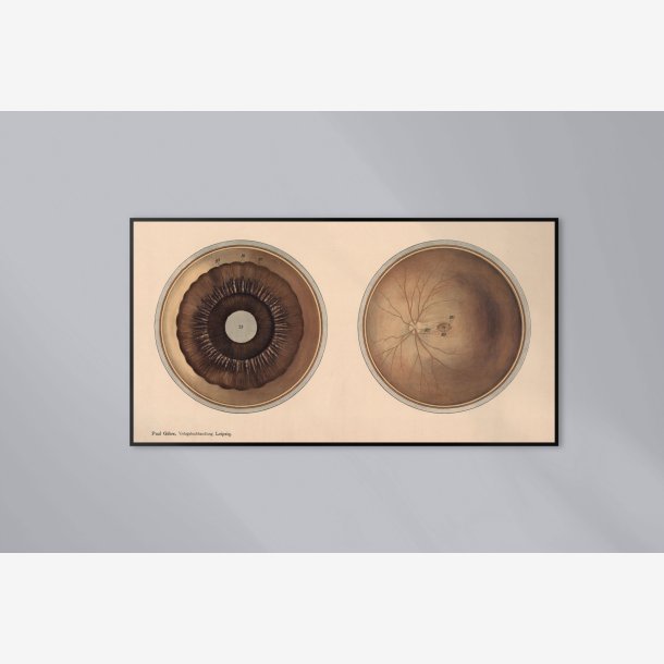 �jet - Frohses anatomiske tavler 1900