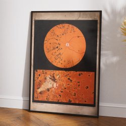 je under mikroskop - R. Liebreich - 1860