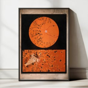 je under mikroskop - R. Liebreich - 1860